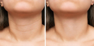 659c31cee2a37923e1eae9dc_eb6ac8b9-b73c-4451-96c0-f8fcf9e9a141