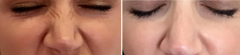 8508E02C-0234-4EE1-AB3E-8602B37F9B7E_720x