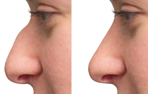 Schermafbeelding 2024-12-29 010938